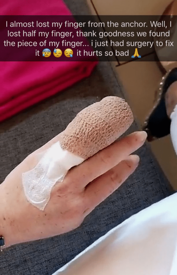 Lindsay shared a picture of her bandaged finger