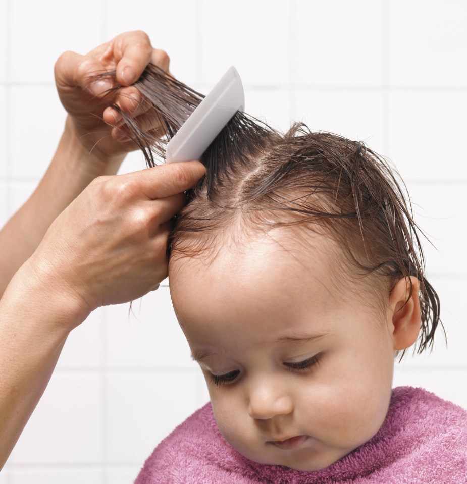  Head lice is a common problem