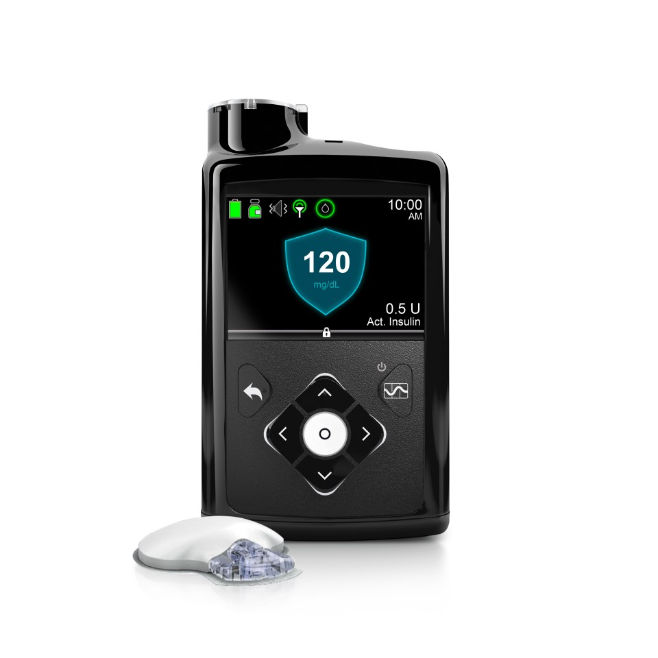  New artificial pancreas was approved by American's Food and Drug Administration regulator for Type 1 diabetes