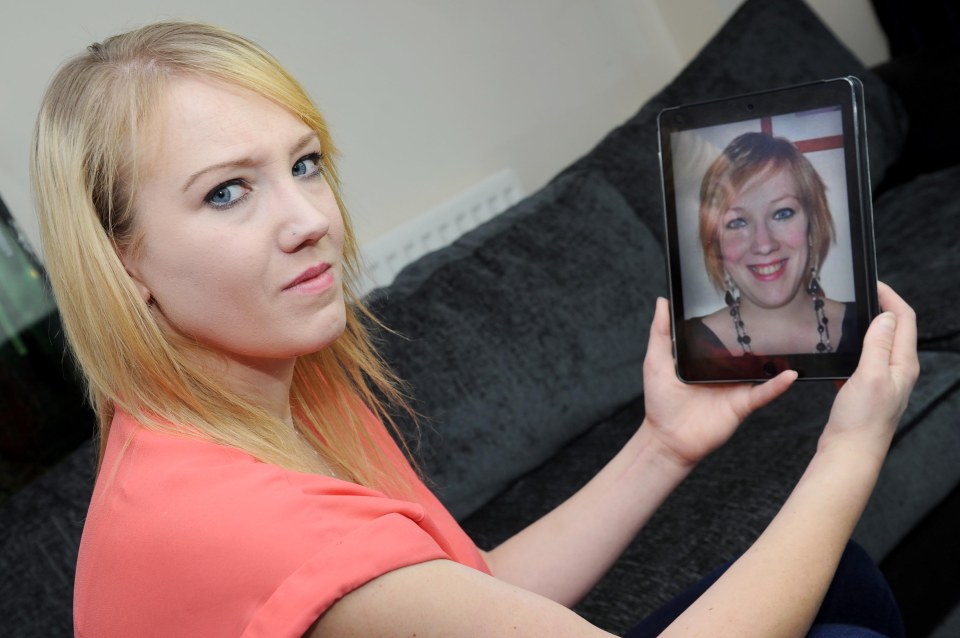  Beth Skerratt suffered such horrific facial injuries in a motorbike crash that she no longer recognised herself