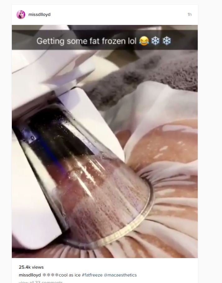  Danielle shared this graphic video of her having her belly fat frozen