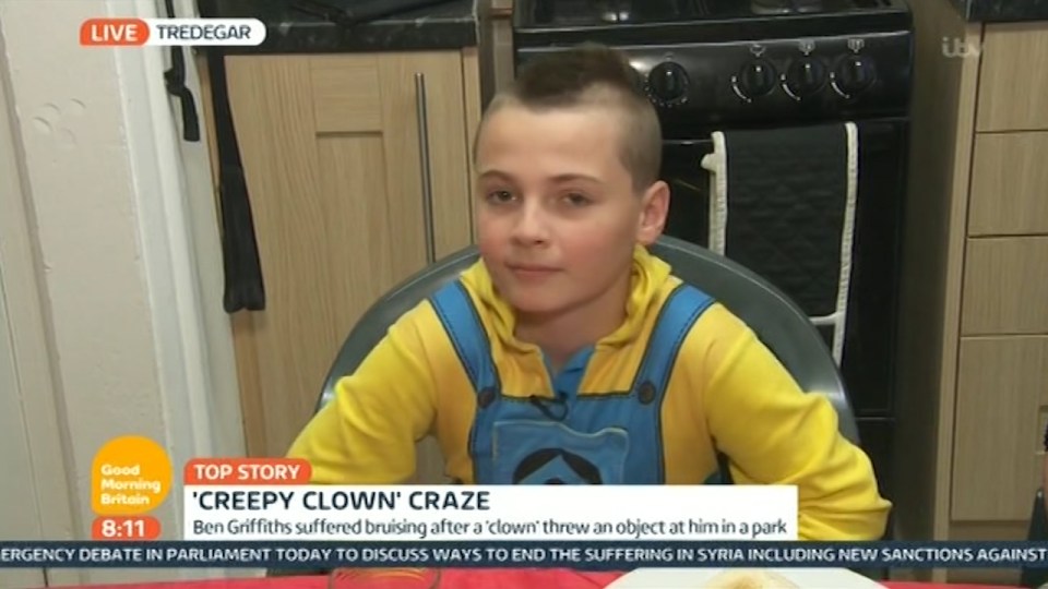  Young boy Ben Griffiths left with bruises after creepy clown attack