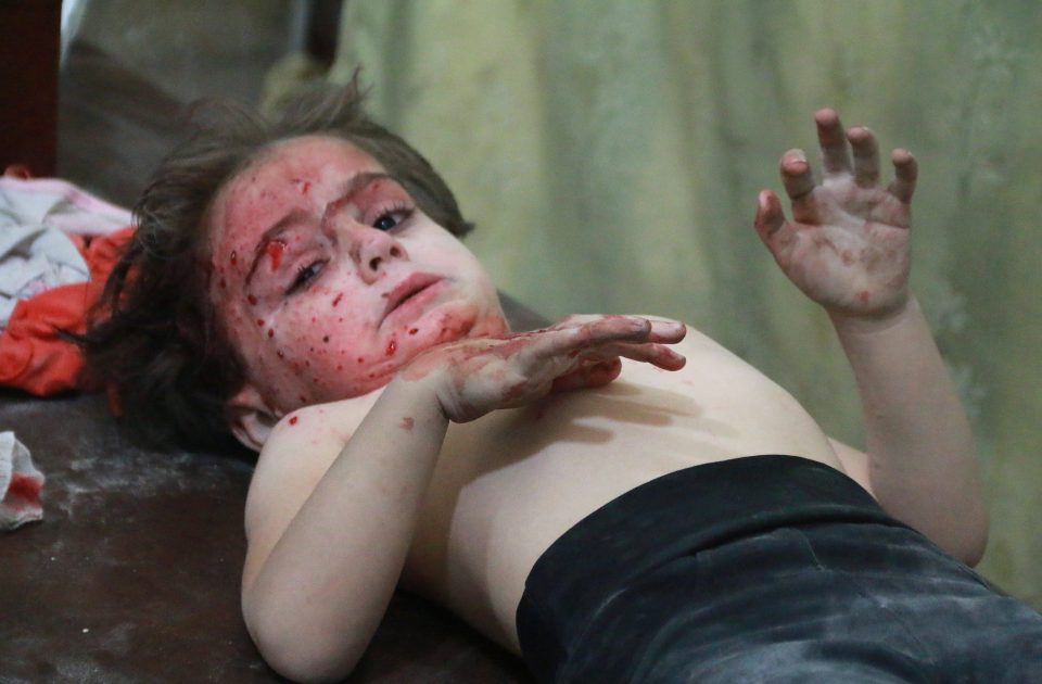  A wounded Syrian child gets treatment at a field hospital