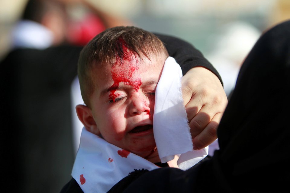  A Shi'ite Muslim child reacts as he bleeds after he was cut on the forehead with a razor