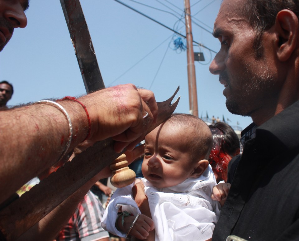  A baby has his head sliced in Bangladesh