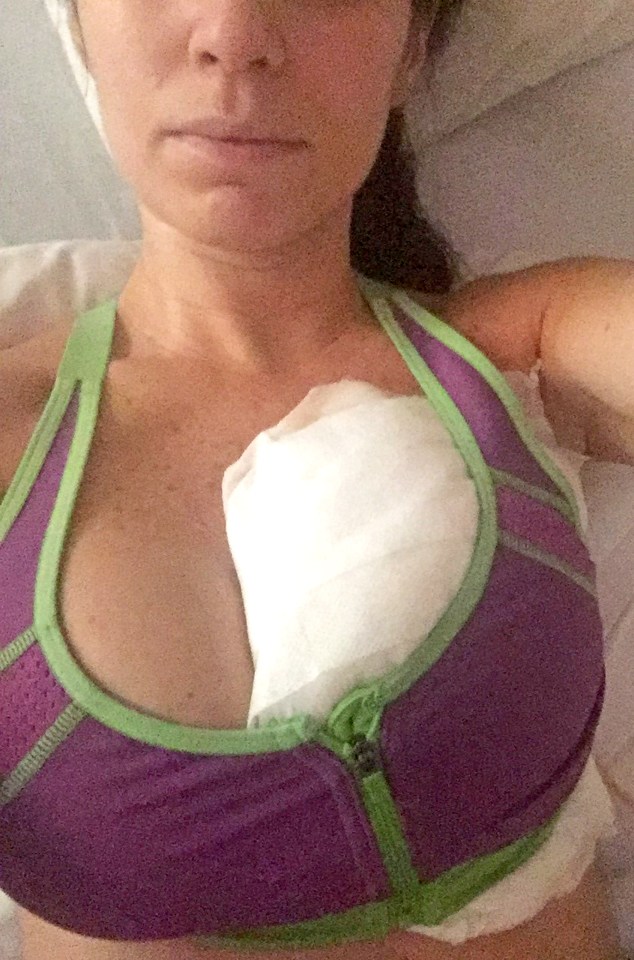  Nikki had to have emergency surgery which left her with only one breast