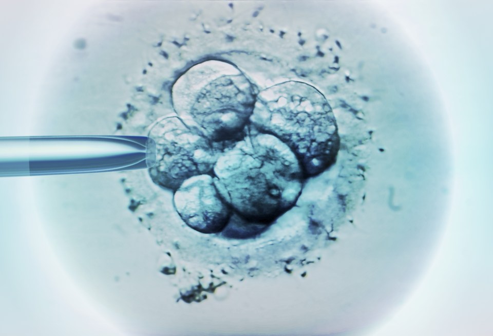 Family campaigners say making it a social rather than medical issue would be “absurd nonsense”. And MPs said it could make it even harder to get IVF on the NHS