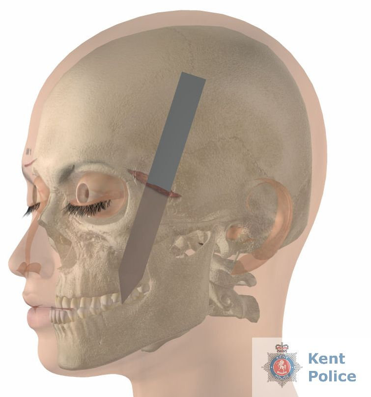  Digital image of how Natasha Sadler-Ellis was knifed in the head