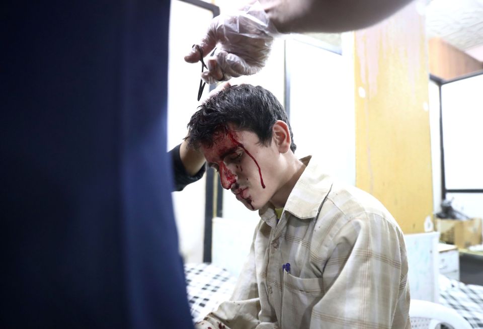  A wounded Syrian man receiving treatment in a makeshift hospital in Douma, which was also hit by raids