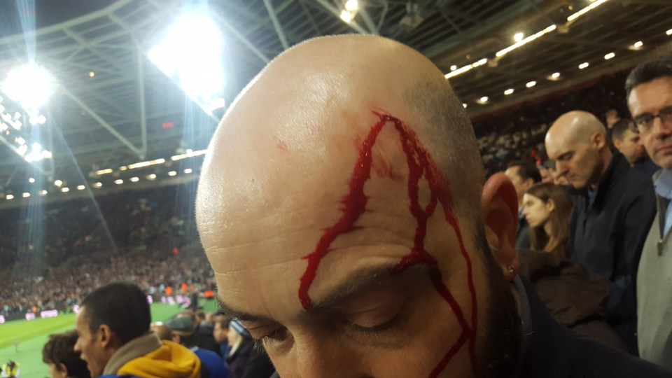 A Chelsea fan was allegedly hit with a coin