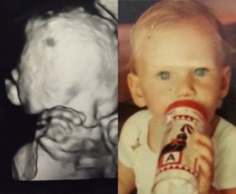  A fan theory suggests that the baby 'must be' Jeremy's as the scan is the spitting image of the star as a tot