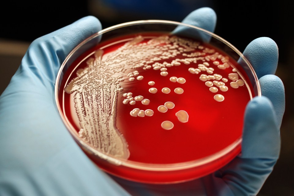 MRSA colonies are seen here on a blood agar plate