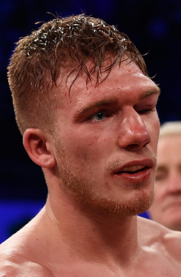  Nick Blackwell has turned to life as a trainer but had to go to hospital again when he tried sparring