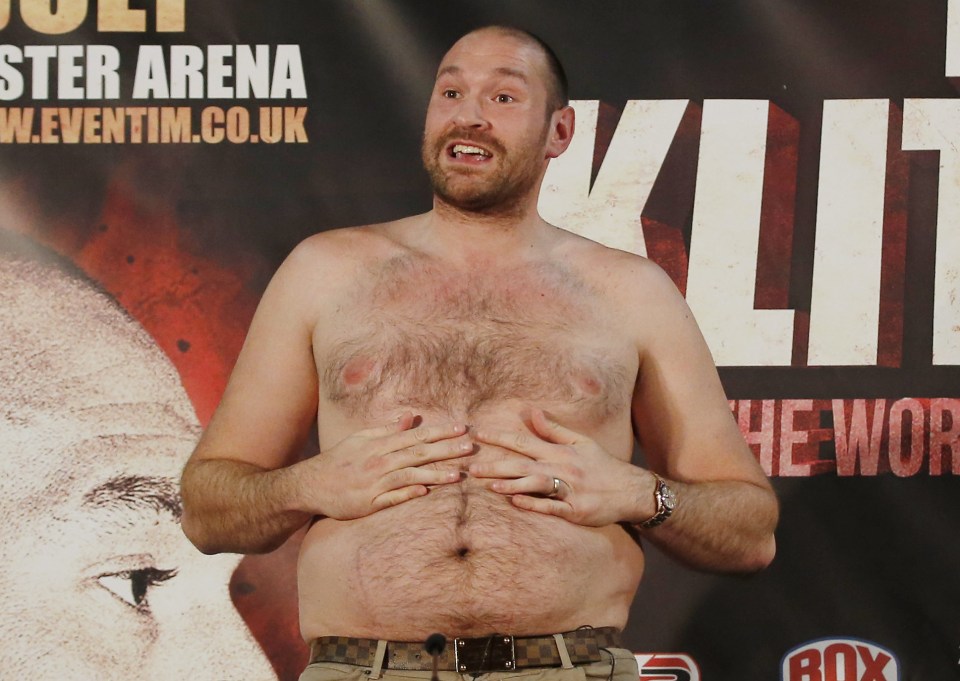  Tyson Fury was told he has a "a version of bipolar" and is "manic depressive"