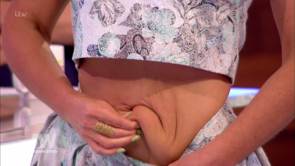  The Big Brother star went under the knife after her six stone weight loss left her with excess skin