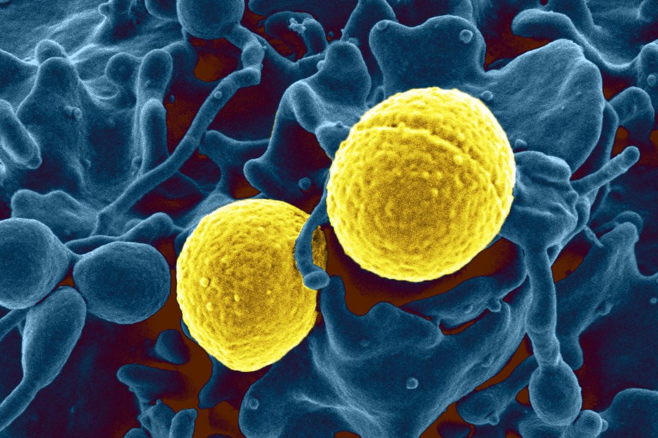 MRSA is resistant to antibiotics with it able to develop into a life threatening condition