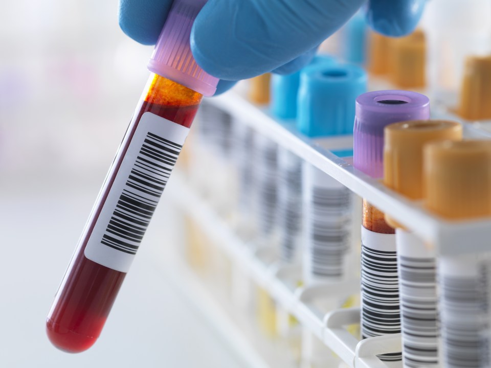  Current bacterial culture tests can take at least two days to confirm a diagnosis