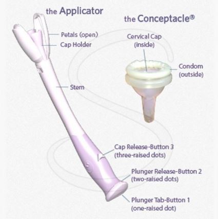  The two-part device collects sperm in the Conceptacle, and the applicator allows sperm to get closer to the cervix