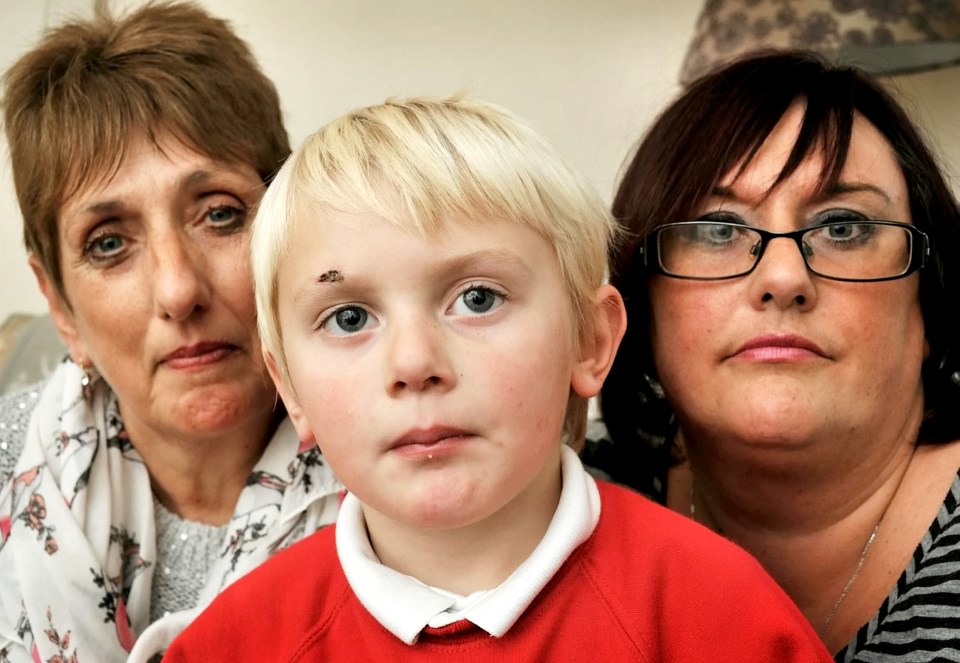  Jay's gran Jayne Gilder and mum Jo Watson blasted the hospital for not covering his eye before applying glue to his head