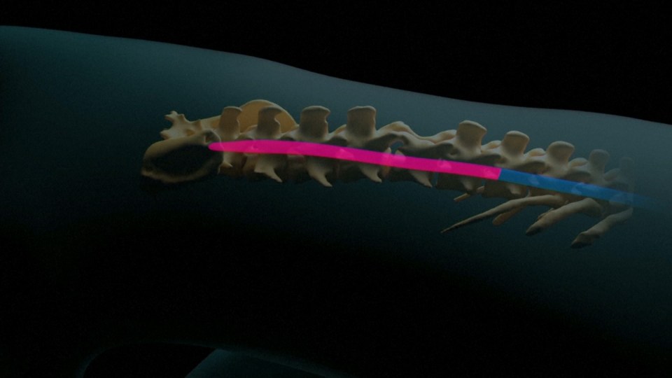 These signals were then beamed back to a stimulator in the monkeys' spines, enabling muscle contractions