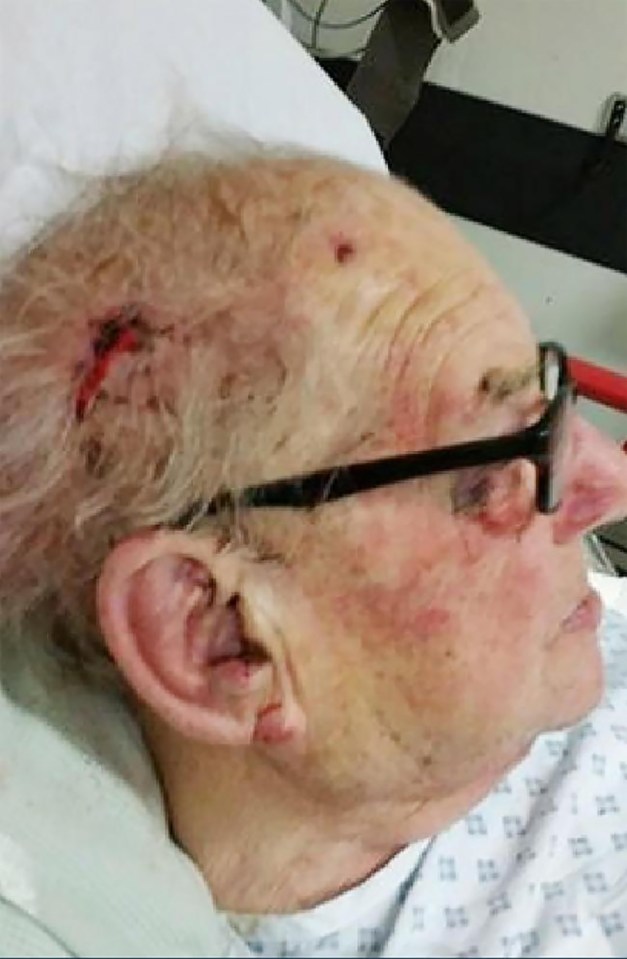 An elderly man known as Aldo was beaten viciously by thugs at his home in Oxfordshire