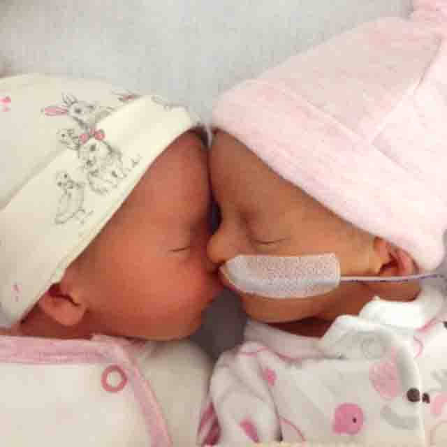  Special delivery: Abbie weighed 4lb 4oz and Megan just 4lb 14oz when they were born