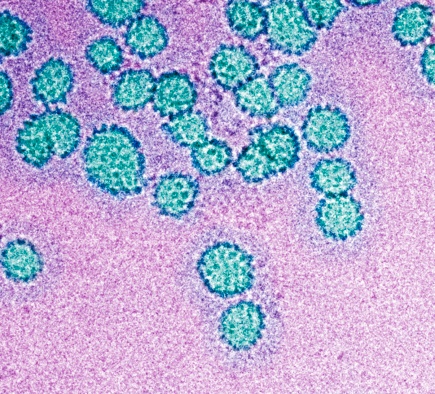 The test screens for signs of the HPV virus, which is responsible for almost all cases of cervical cancer