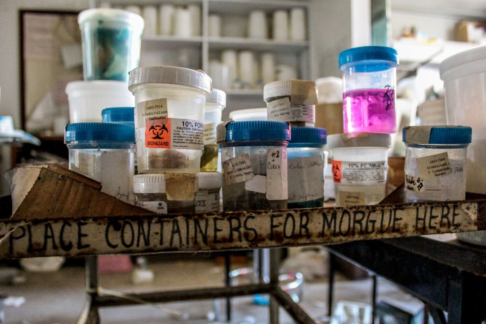 Rotting body parts and blood specimens ready for the morgue have been abandoned 