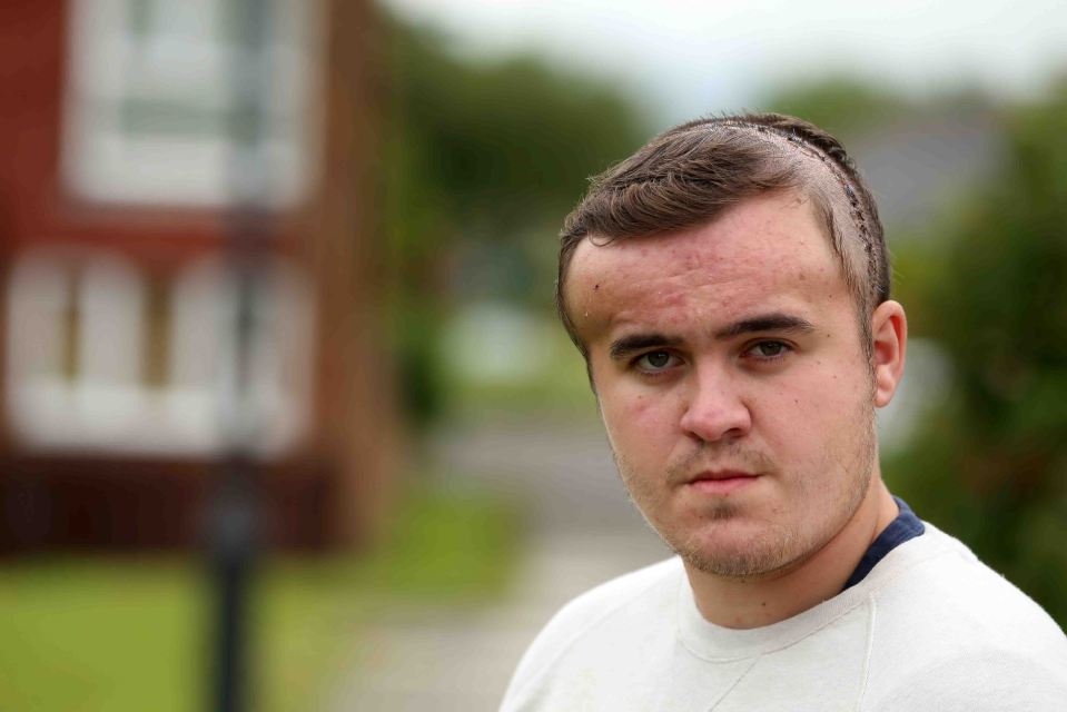 Billy Close was celebrating his 19th birthday in Newcastle when he was attacked