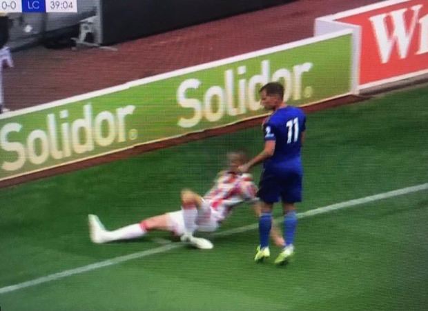  Ryan Shawcross suffered a horrific leg injury during Stoke's pre-season game against Leicester