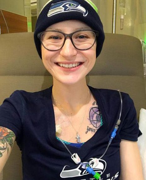  Having chemo has made her lose her hair