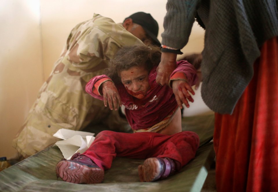  An Iraqi girl injured during clashes in the Islamic State ... Many of the 926 civilians killed in November were children