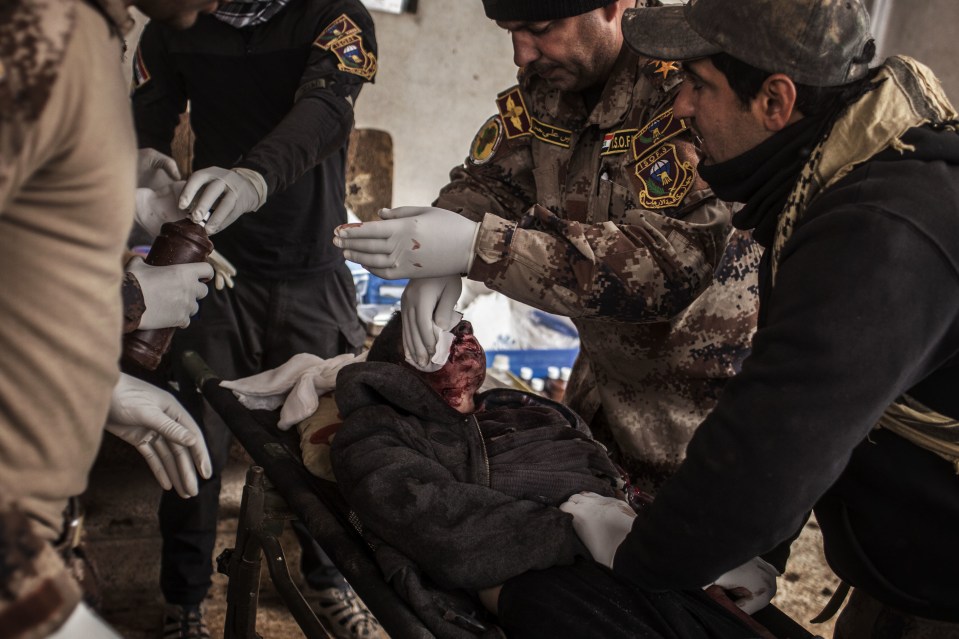  A badly injured boy is tended to by Iraqi medics