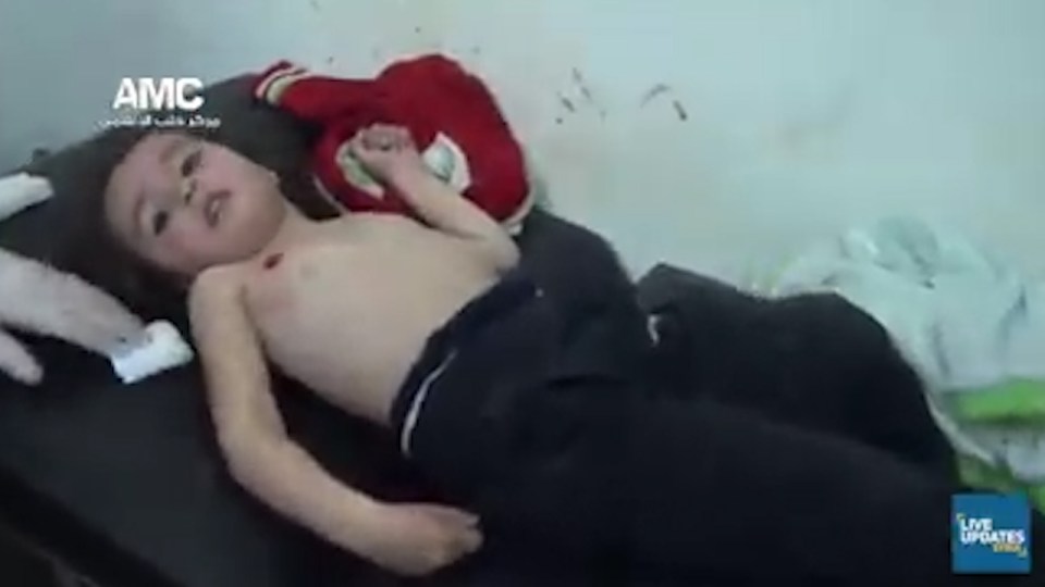  In the video, the young child can be seen lying on a bed with a gunshot wound clearly visible on her chest