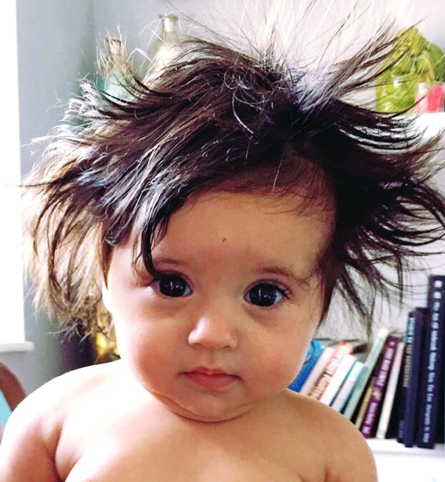  This is little Maya at four months old with a full head of hair