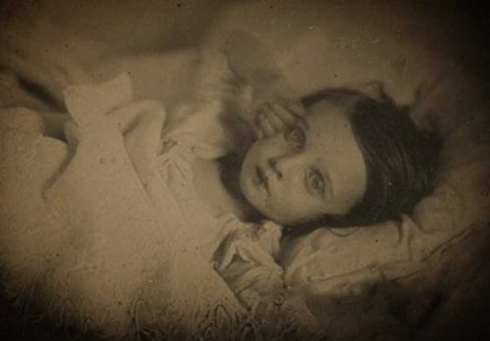  Taken in 1850, this photo shows a girl with her eyes propped open and her hand by her head as if she is lying awake in bed