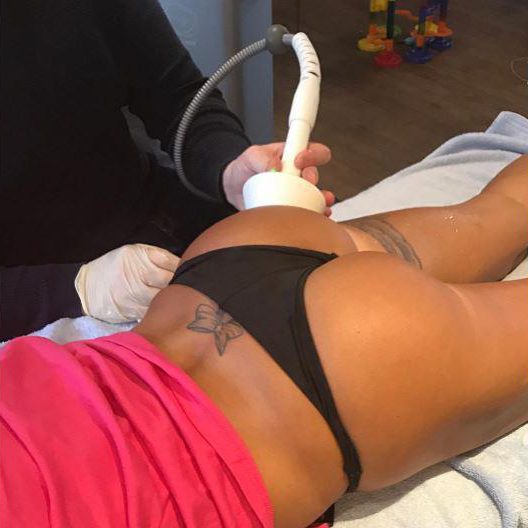  Katie Price treated fans on Monday with this cheeky snap while receiving her fifth non-surgical bum lift