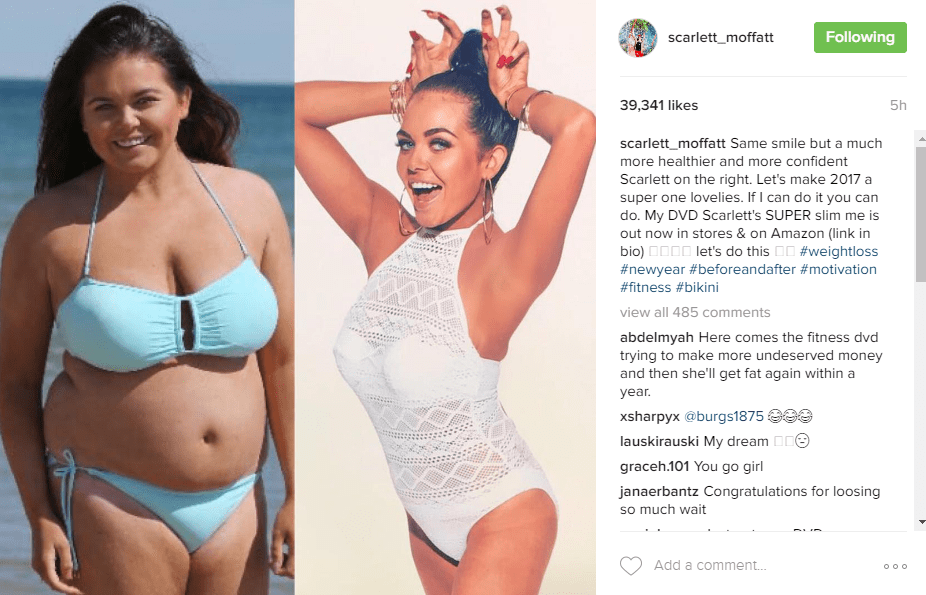  Scarlett Moffatt shared the amazing before and after shots on Instagram earlier today