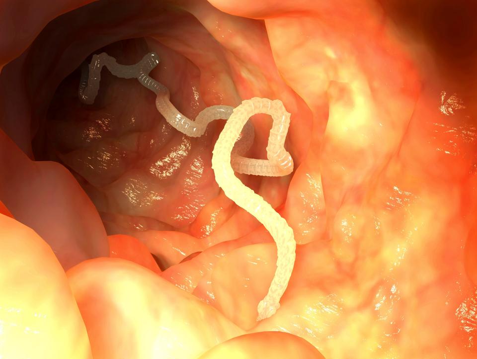  Tapeworms can grow up to 55ft long and can be life-threatening to humans