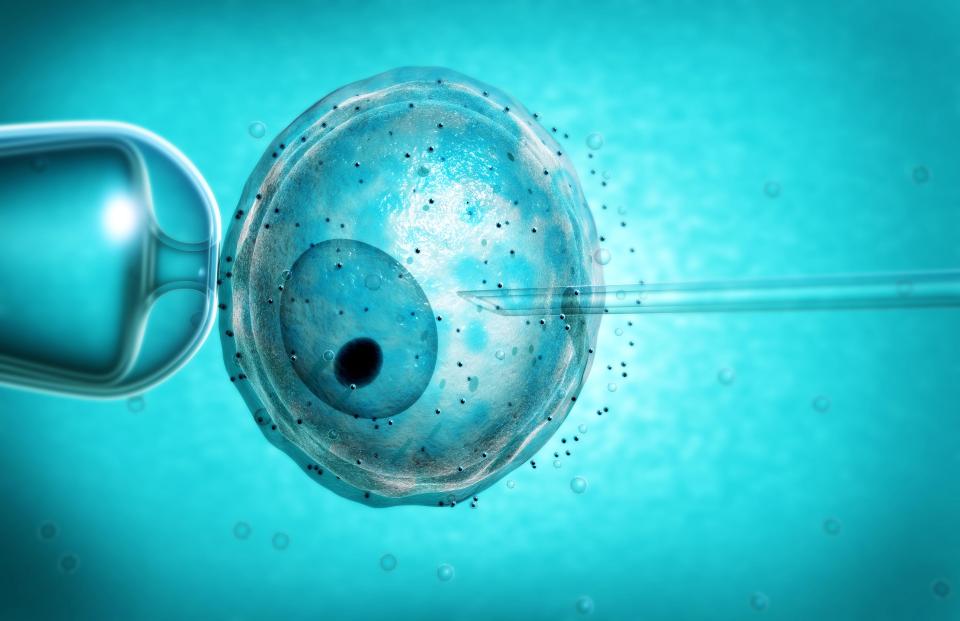 Parents struggling to have children could benefit from the IVF innovation