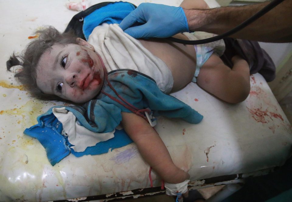  Doctors tend to an injured Syrian toddler hurt in Russian airstrikes