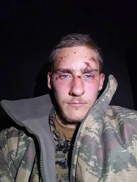  Ryan, pictured after the raid by Turkish jets, was shot in the head while battling to recapture the ISIS stronghold of Raqqa