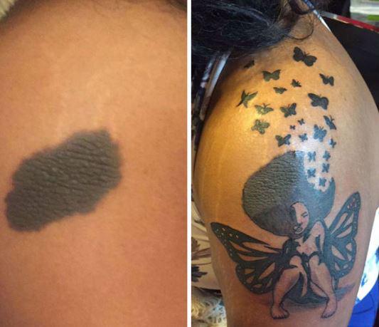  A woman used her dark mark as inspiration for a pretty angel tattoo