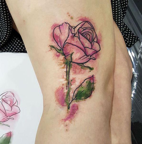  A woman had the outline of a rose tattooed on top of her pink birthmark