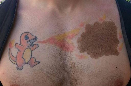  A Pokemon fan gets his favourite character etched next to his flame-shaped blemish