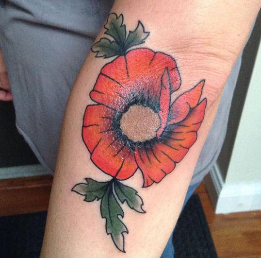  A poppy is doodled around a circular brown birthmark