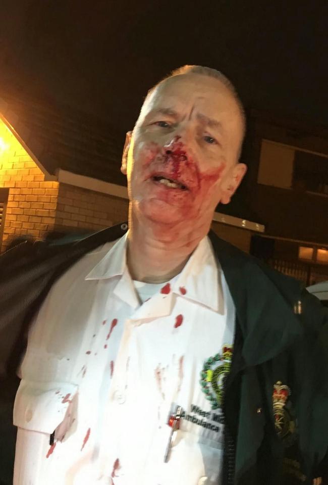  Bob Burness, pictured, was left with blood pouring from his face after an unprovoked attack by a patient