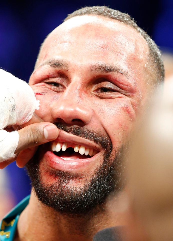  James DeGale lost a front tooth during his bout with Badou Jack