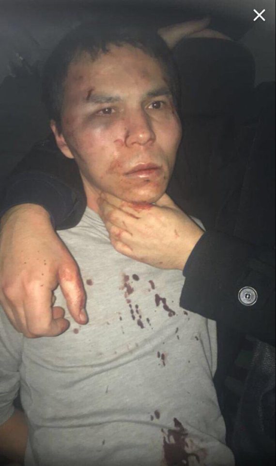  A bloodied Abdulkadir Masharipov pictured following his arrest in Istanbul