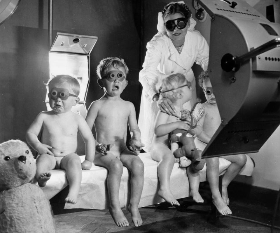  Young children at a Bristol health centre using sun lamps, often used to treat skin conditions. They must wear special glasses to protect their eyes